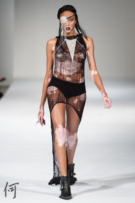 Chantelle Brown, Model with Vitiligo, Sexton