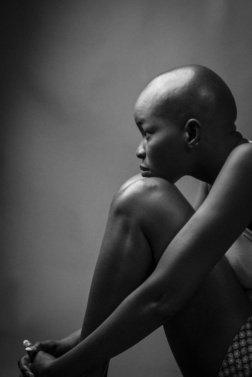Exposure Project, Black Women cancer, Kea Taylor Photography, Zuri works