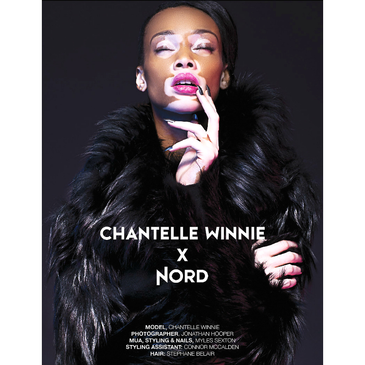 Winnie Harlow, Black Models Vitiligo, Winnie Harlow America's Next Top Model, NORD Magazine, Vitiligo Dark Skin
